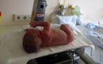 Neugeborenen-Untersuchung - Kontrolle erster Lebenszeichen