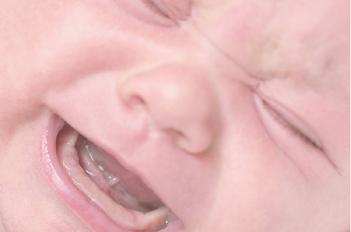 Babyzähne - so bleiben sie gesund