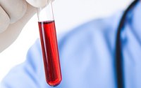 Hämophilie - erhöhte Blutungsneigung